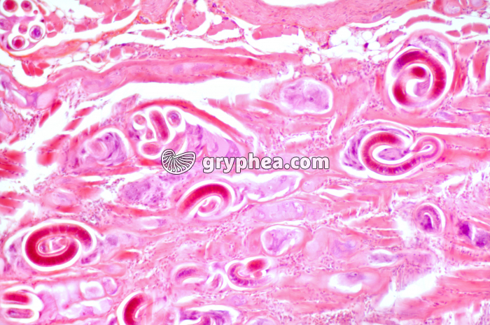 Trichine - Ver parasite - Trichinella spiralis dans une coupe de muscle  x40 - gryphea.com
